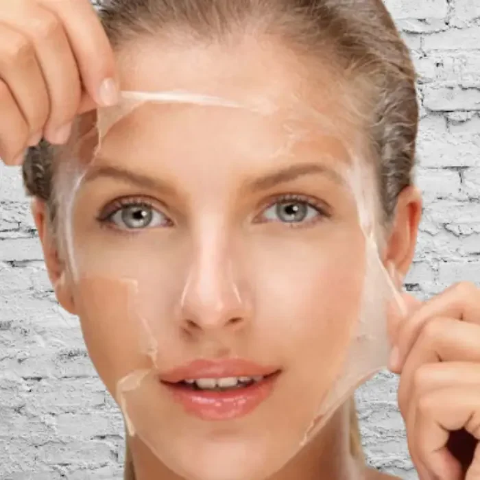 peeling 2